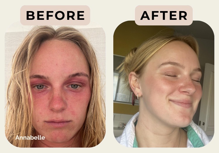 Annabelle — before and after