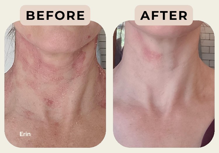Erin — before and after