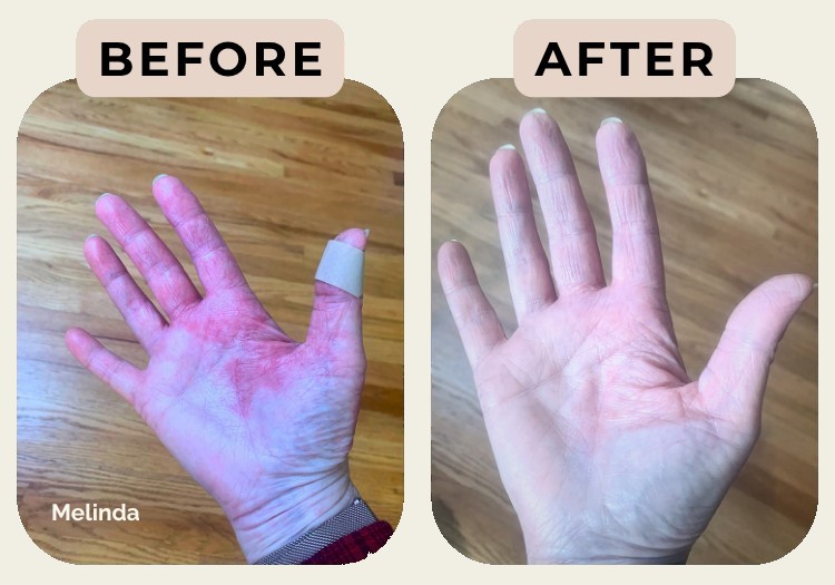 Melinda — before and after