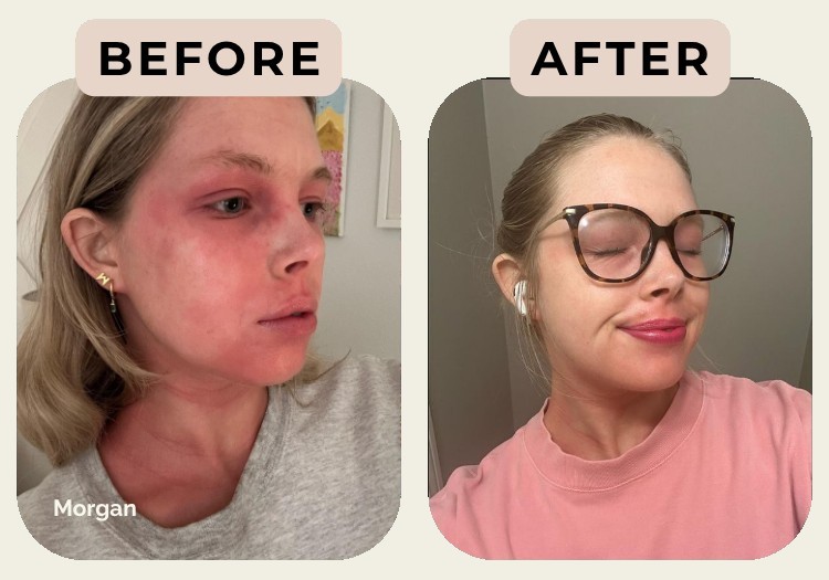 Morgan — before and after