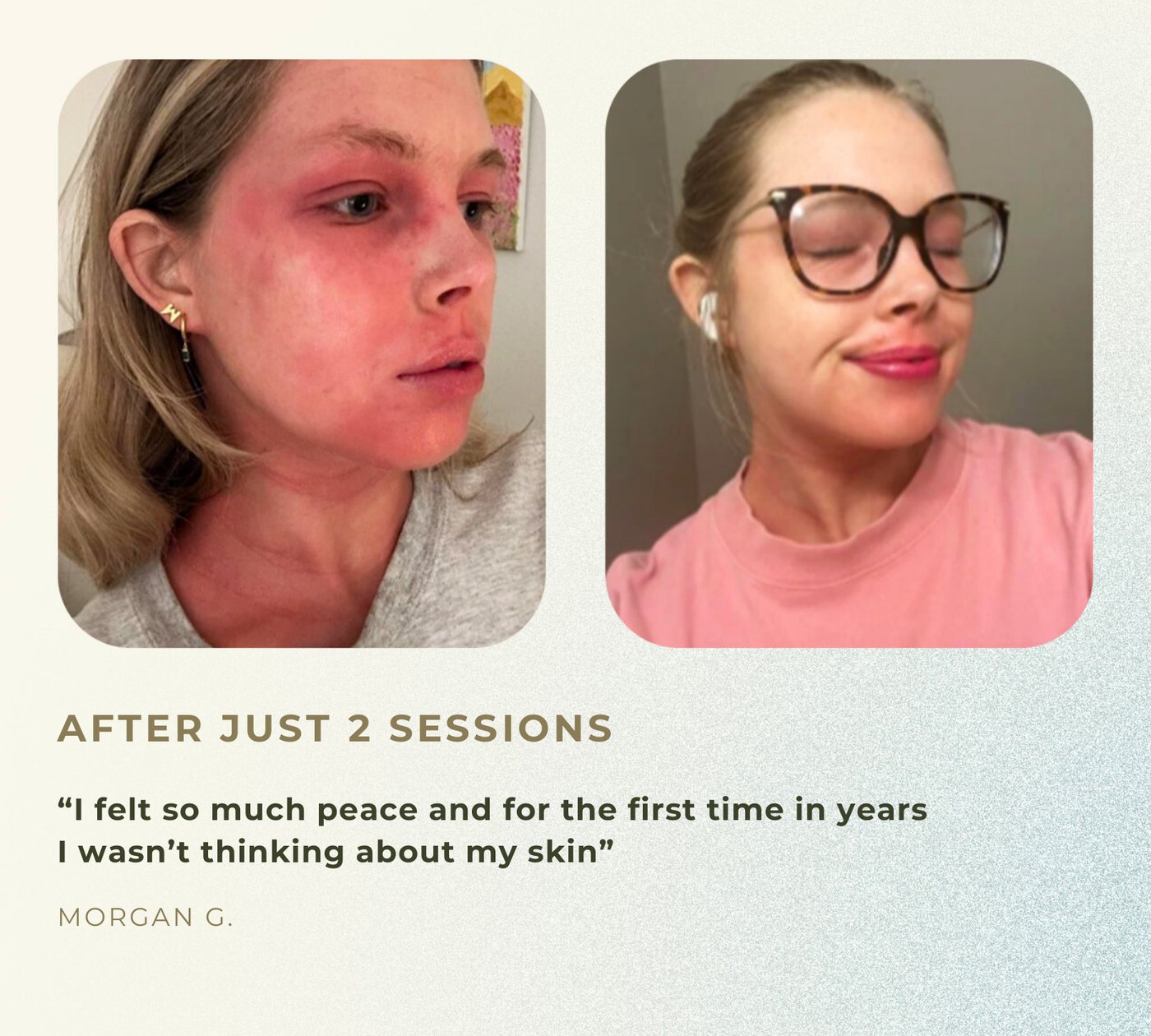 Morgan, before and after just two sessions